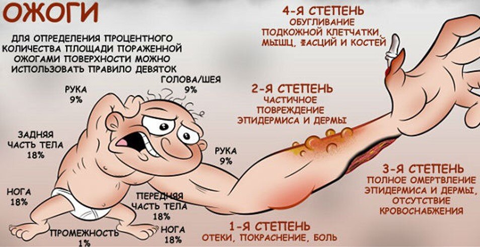 Читать далее о этой статье Первая помощь при ожогах